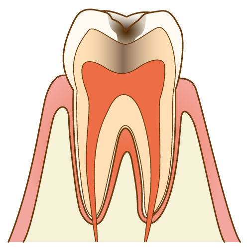 ⊕拡大：C2の歯の断面図